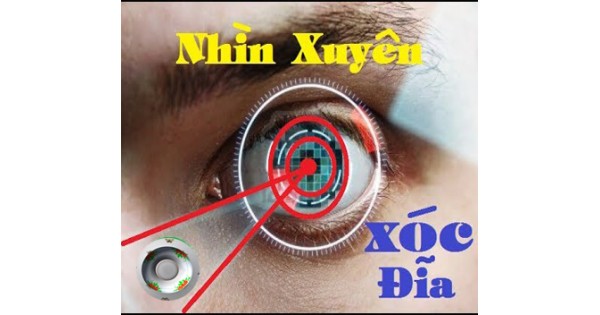 Kinh áp tròng nhìn xuyên bài xóc đĩa